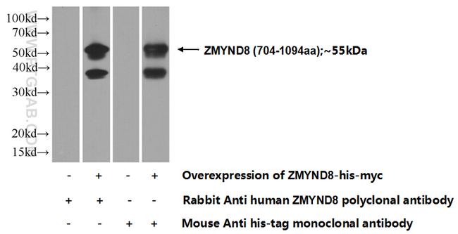 ZMYND8 Antibody in Western Blot (WB)