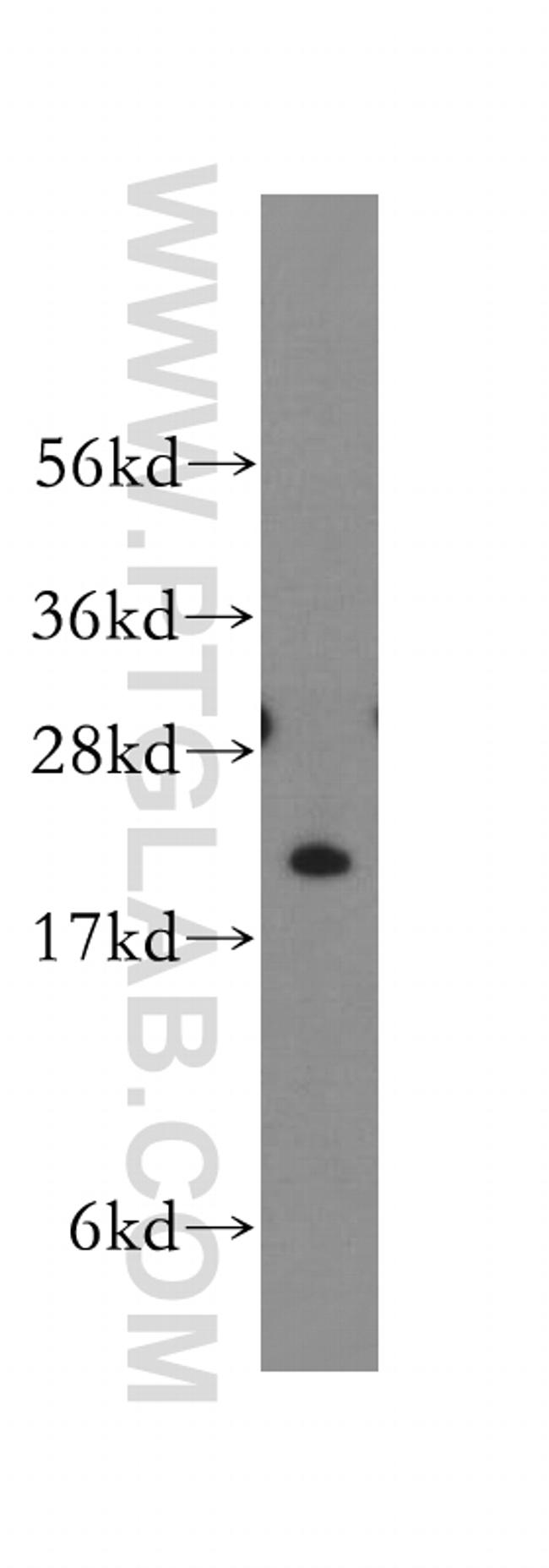 TNNI2 Antibody in Western Blot (WB)