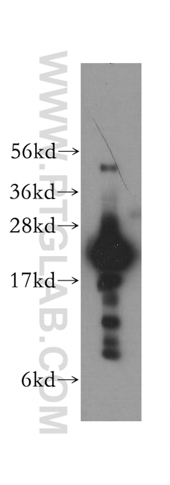 TNNI2 Antibody in Western Blot (WB)
