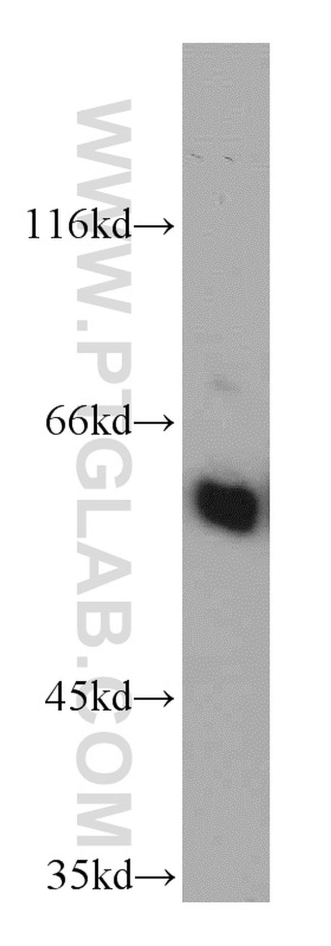 CSN1 Antibody in Western Blot (WB)