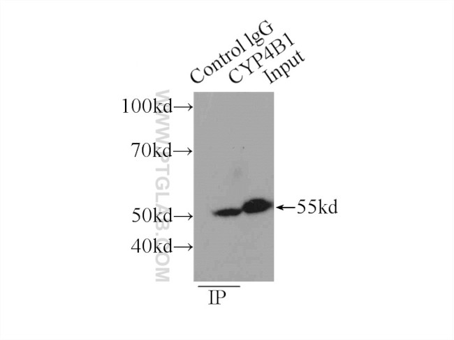 CYP4B1 Antibody in Immunoprecipitation (IP)
