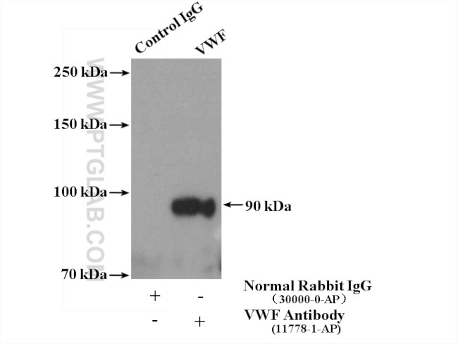 VWF/VWFpp Antibody in Immunoprecipitation (IP)