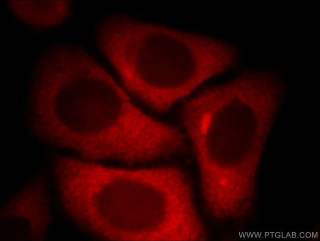 KYNU Antibody in Immunocytochemistry (ICC/IF)