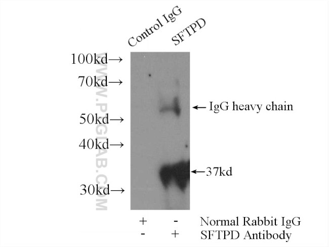 Surfactant protein D Antibody in Immunoprecipitation (IP)
