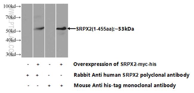 SRPX2 Antibody in Western Blot (WB)
