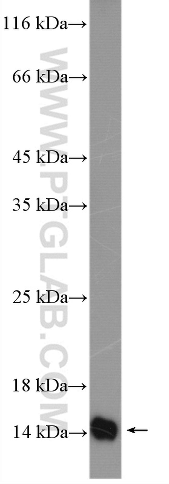 Galectin-1 Antibody in Western Blot (WB)