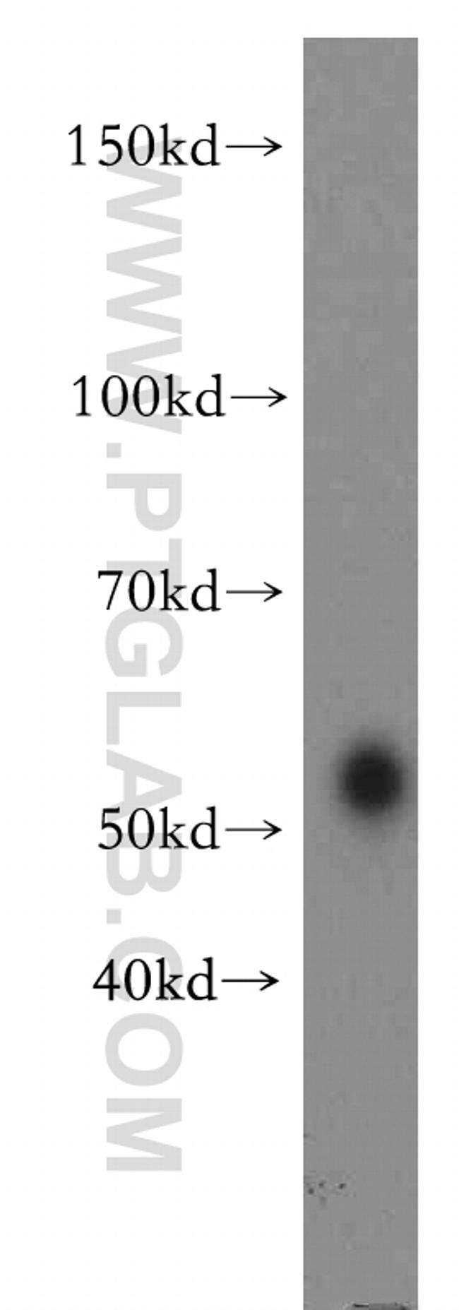 RAMP3 Antibody in Western Blot (WB)