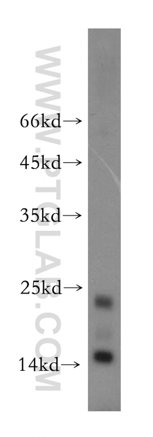 SH2D1B Antibody in Western Blot (WB)