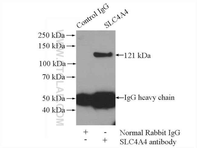 SLC4A4 Antibody in Immunoprecipitation (IP)