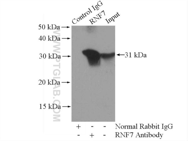 RNF7 Antibody in Immunoprecipitation (IP)