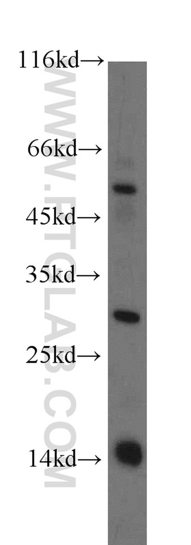 RNF7 Antibody in Western Blot (WB)