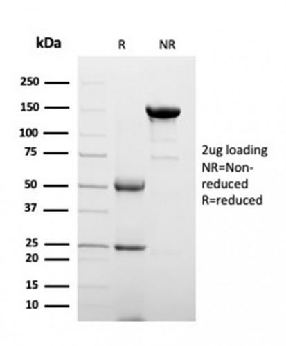 Clusterin/Apolipoprotein J (APO-J) Antibody in SDS-PAGE (SDS-PAGE)
