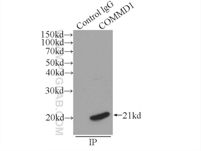 COMMD1 Antibody in Immunoprecipitation (IP)