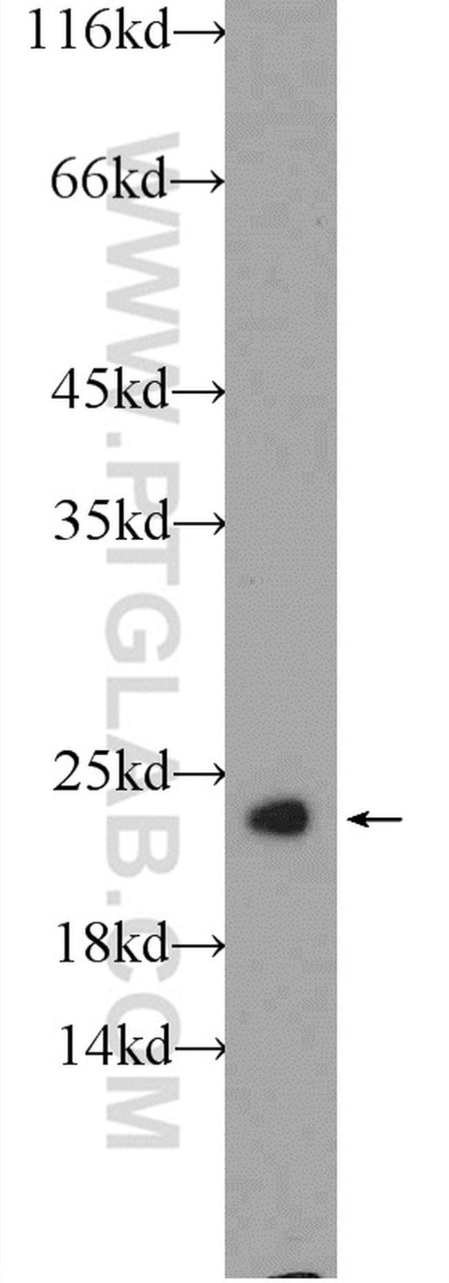 RAB5A Antibody in Western Blot (WB)