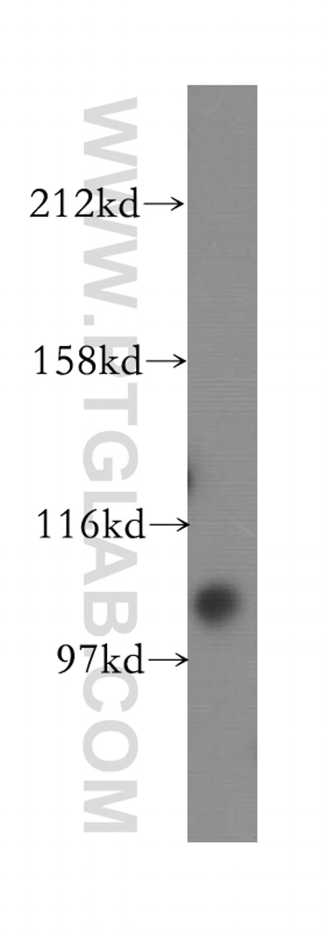 URG4 Antibody in Western Blot (WB)