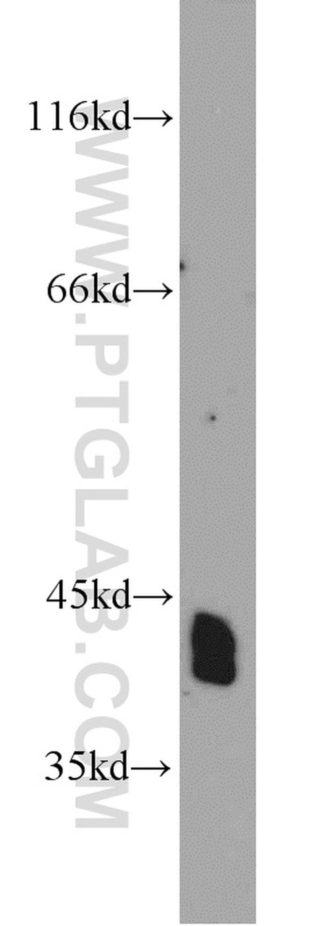 NDRG2 Antibody in Western Blot (WB)