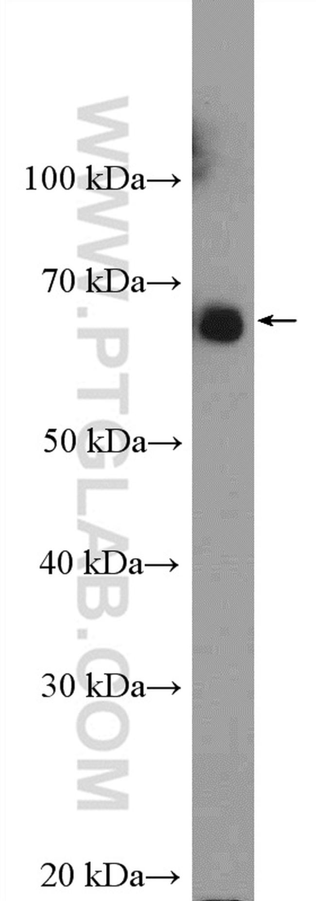 SF3A3 Antibody in Western Blot (WB)