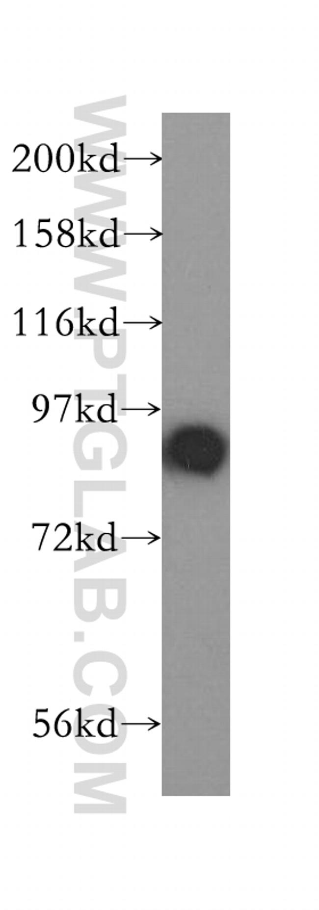 STAT5B Antibody in Western Blot (WB)