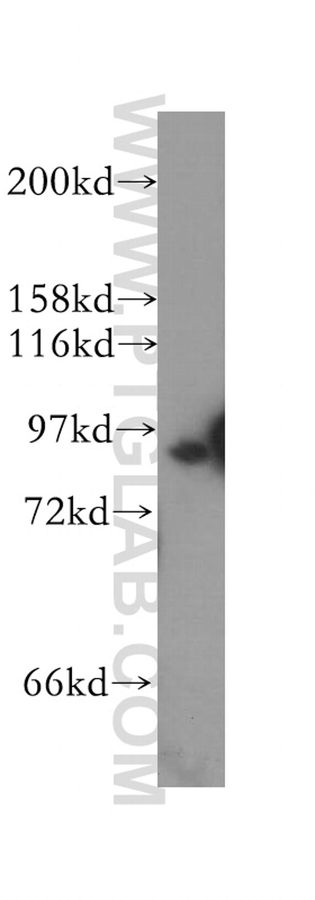 STAT5B Antibody in Western Blot (WB)