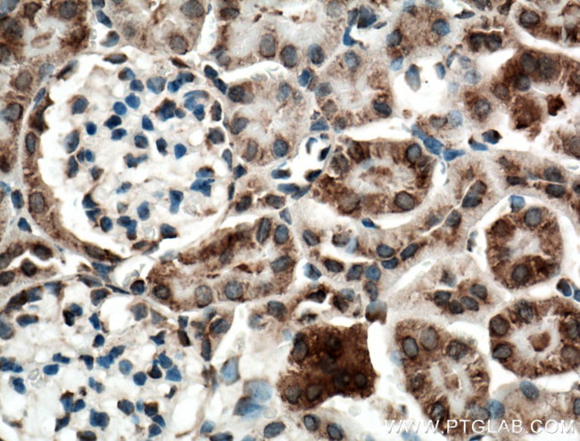 SLC25A10 Antibody in Immunohistochemistry (Paraffin) (IHC (P))