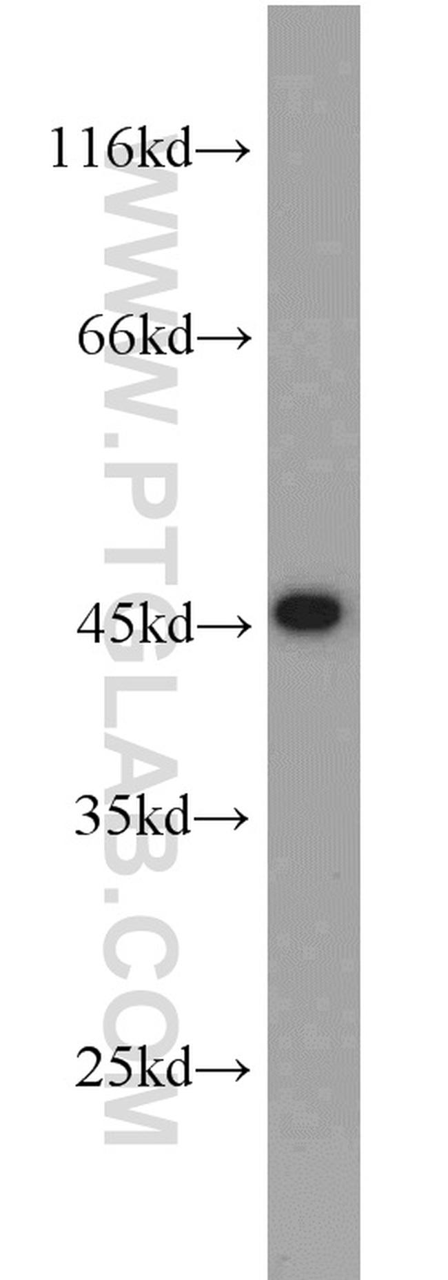 UBA5 Antibody in Western Blot (WB)