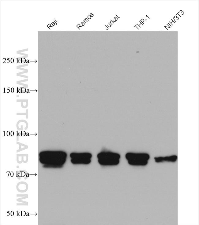 CIN85 Antibody in Western Blot (WB)
