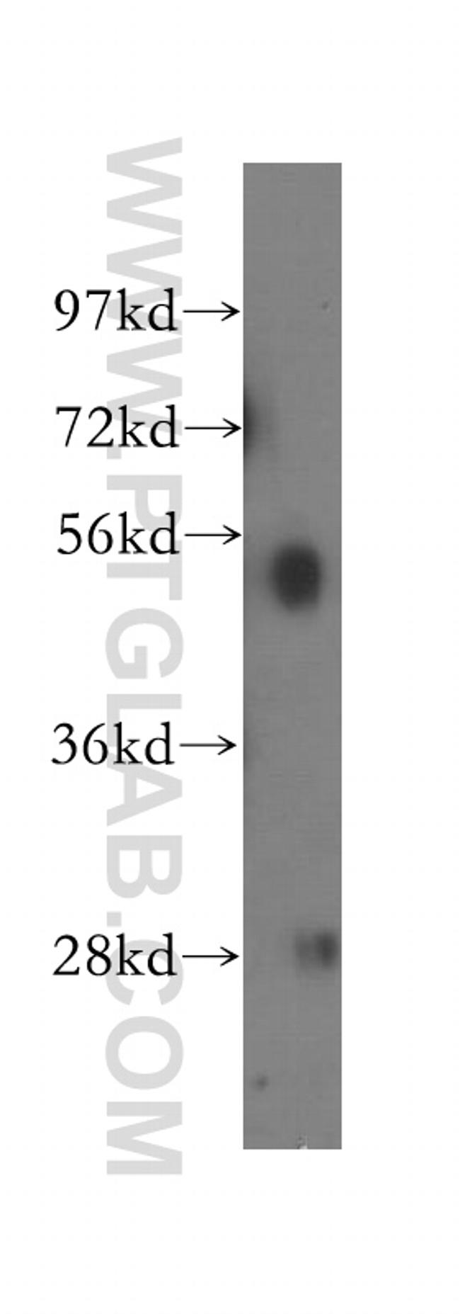 NARF Antibody in Western Blot (WB)