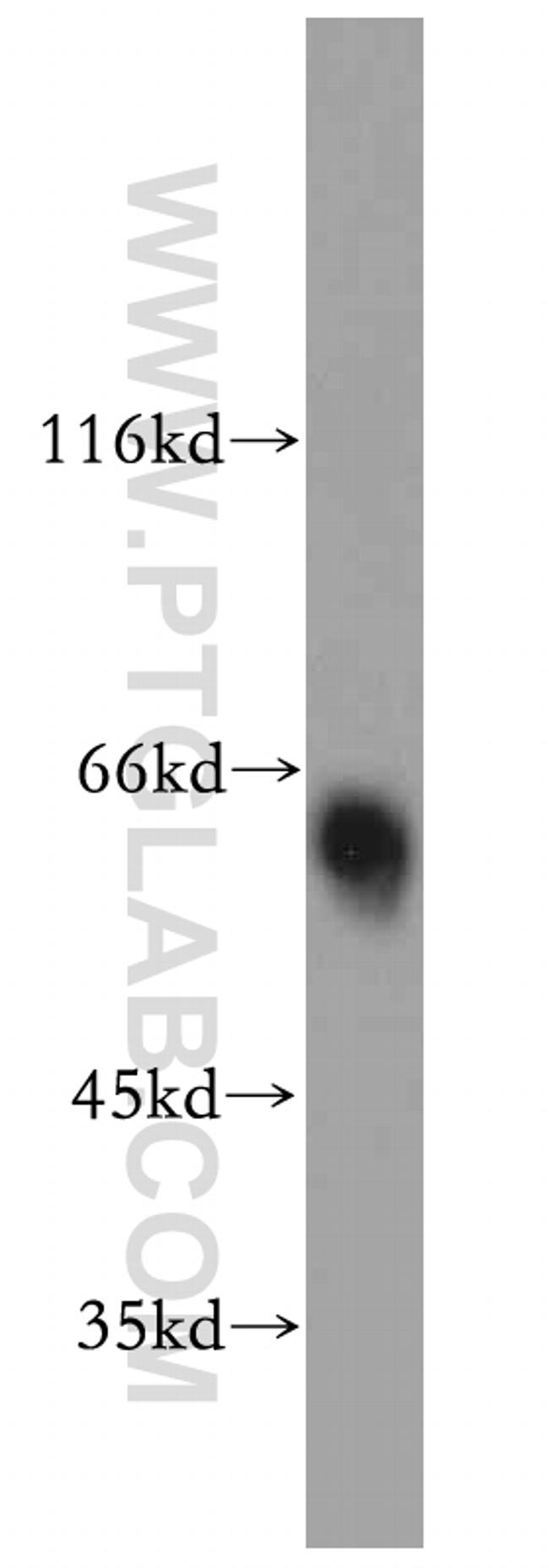 alpha 1 Antichymotrypsin Antibody in Western Blot (WB)