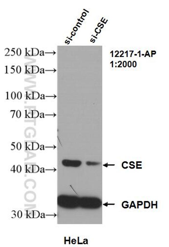 Gamma cystathionase Antibody in Western Blot (WB)