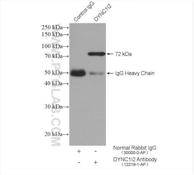 DYNC1I2 Antibody in Immunoprecipitation (IP)