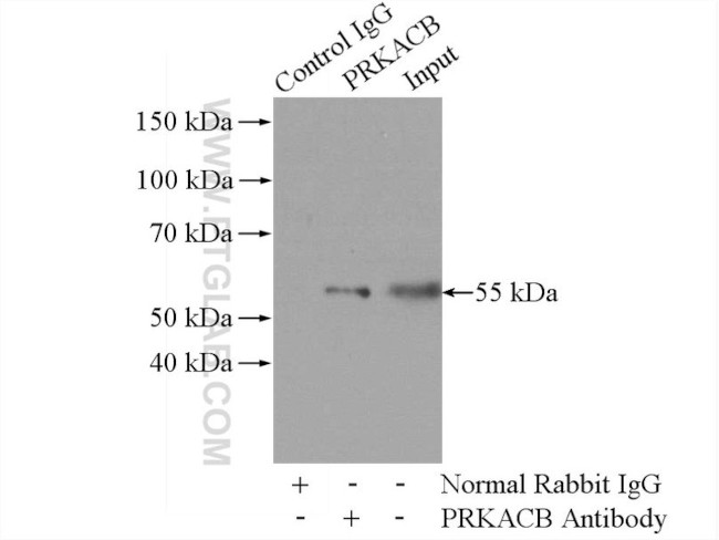 PRKACB Antibody in Immunoprecipitation (IP)