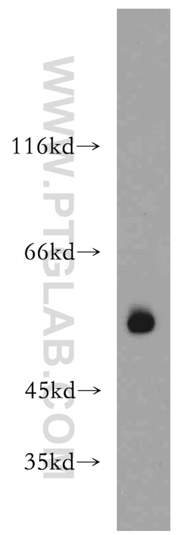 PRKACB Antibody in Western Blot (WB)