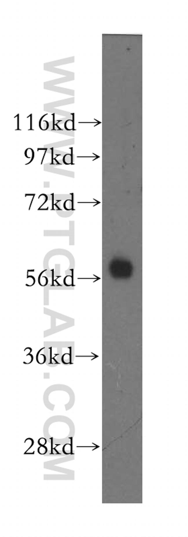 MTMR8 Antibody in Western Blot (WB)