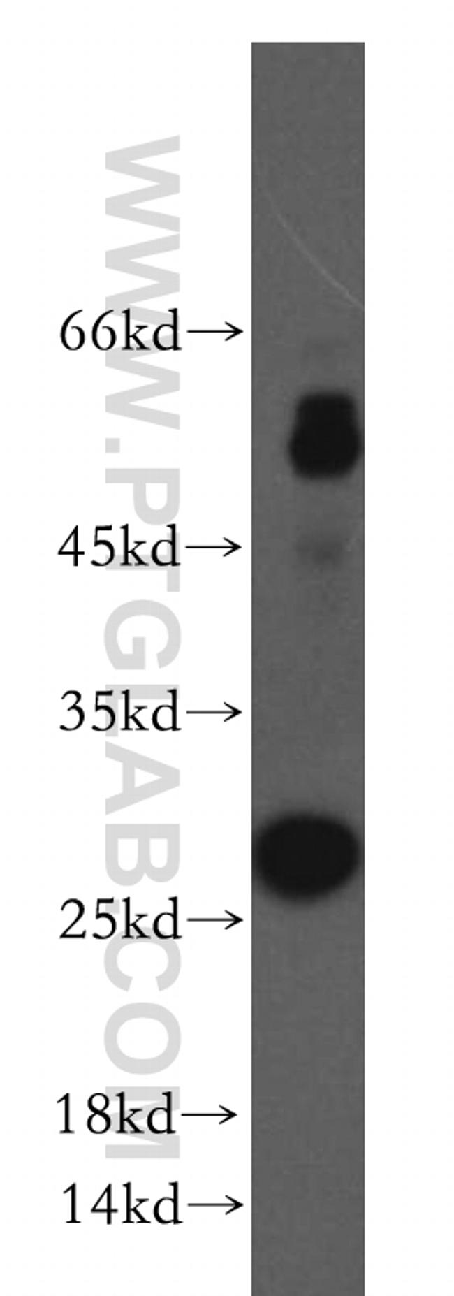 TIMP-4 Antibody in Western Blot (WB)