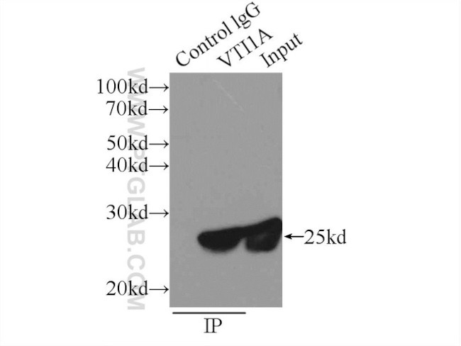 VTI1A Antibody in Immunoprecipitation (IP)