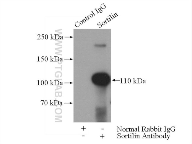 Sortilin Antibody in Immunoprecipitation (IP)