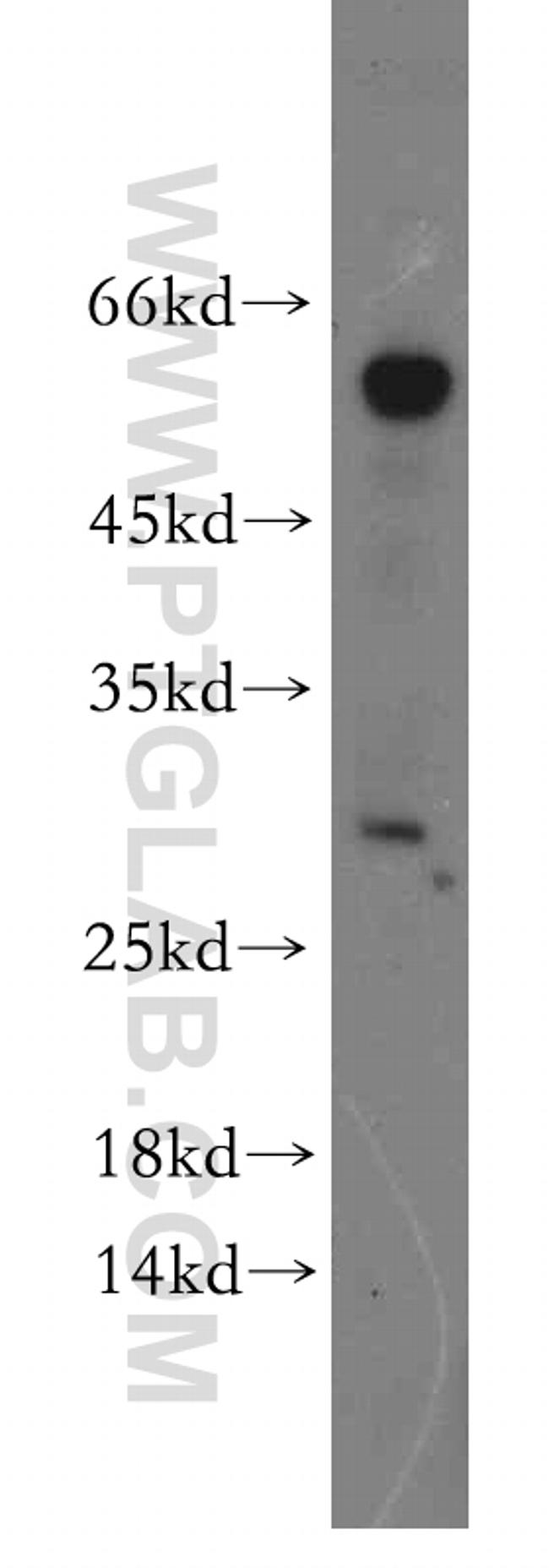 SSX5 Antibody in Western Blot (WB)