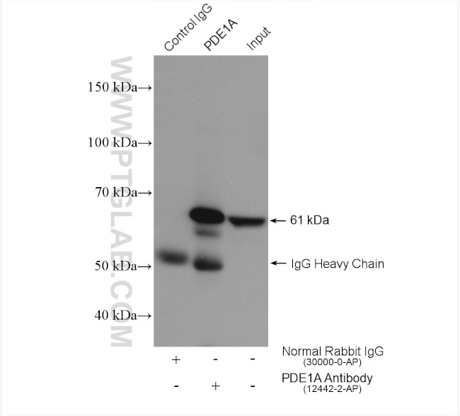 PDE1A Antibody in Immunoprecipitation (IP)