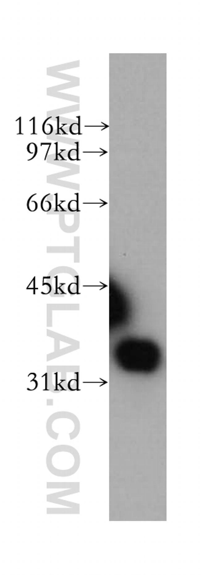 SULT1E1 Antibody in Western Blot (WB)