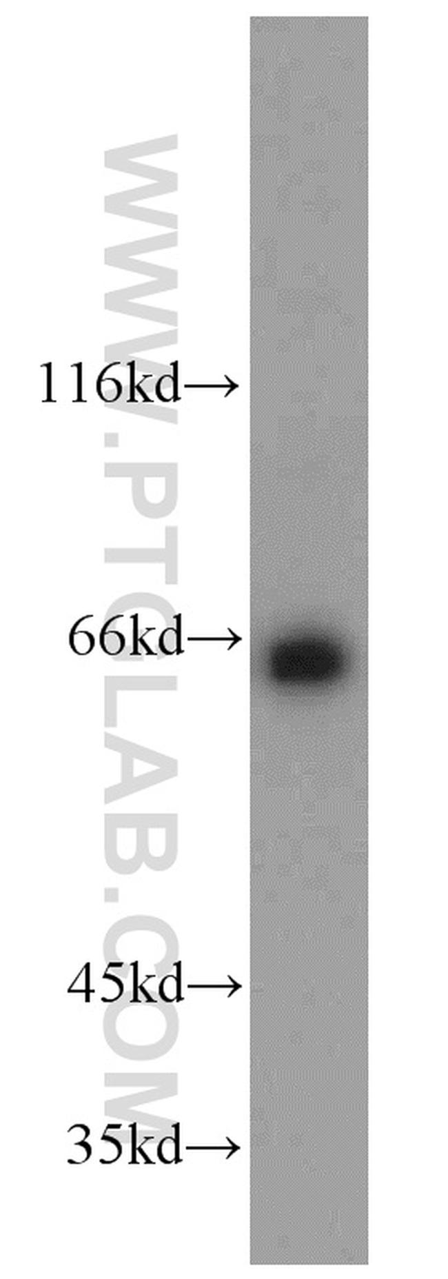 PPIL4 Antibody in Western Blot (WB)
