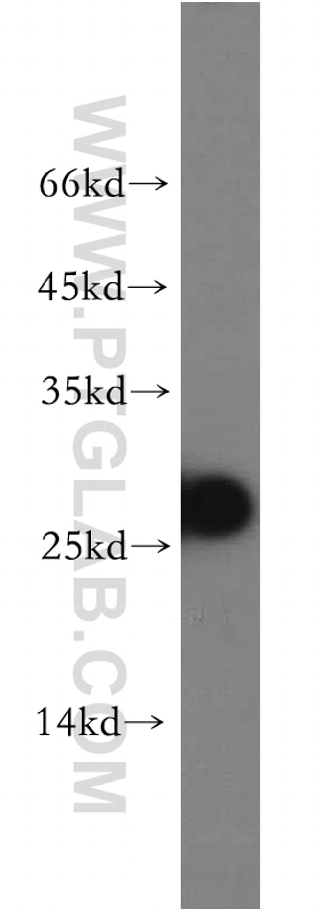 AK3 Antibody in Western Blot (WB)