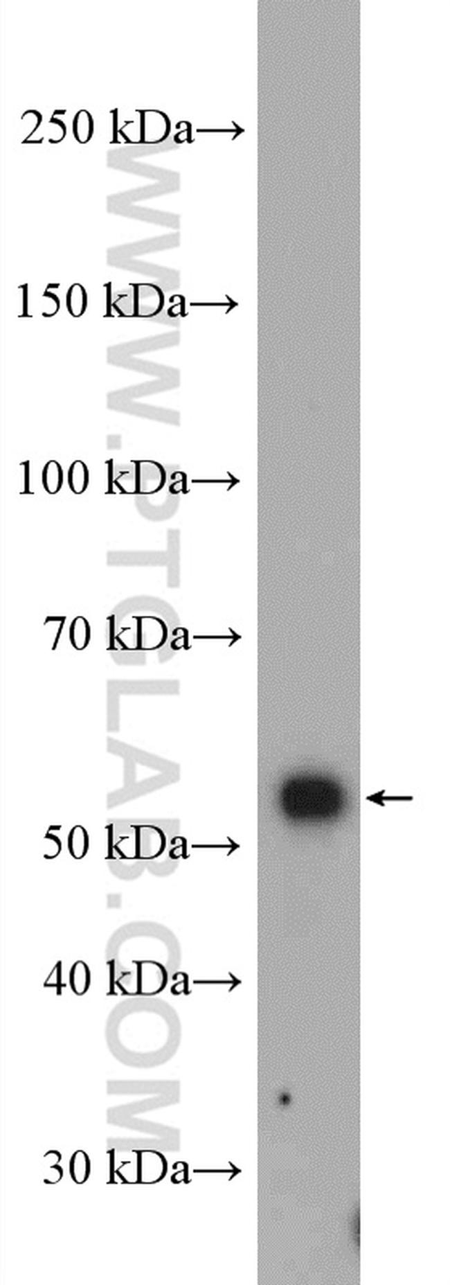 SMAD2 Antibody in Western Blot (WB)
