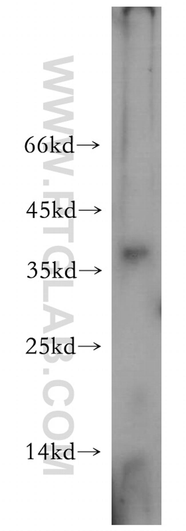 AKAP7 Antibody in Western Blot (WB)