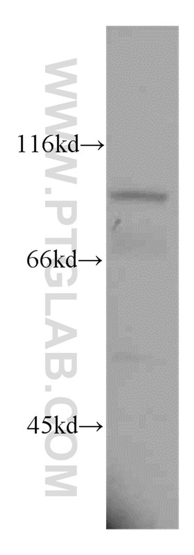 PANX1 Antibody in Western Blot (WB)