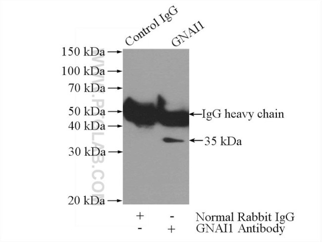 GNAI1 Antibody in Immunoprecipitation (IP)