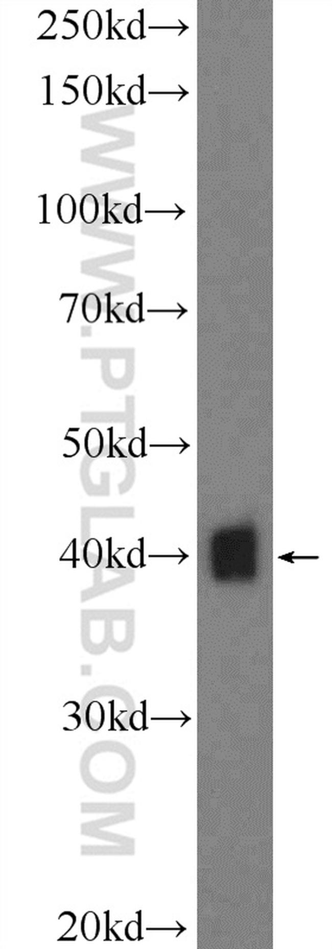 GNAO1 Antibody in Western Blot (WB)