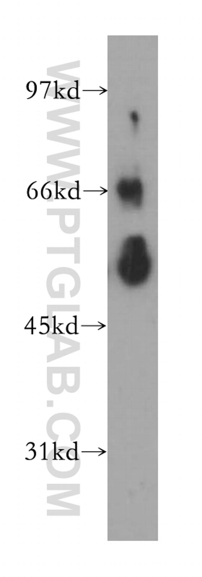 TULP2 Antibody in Western Blot (WB)