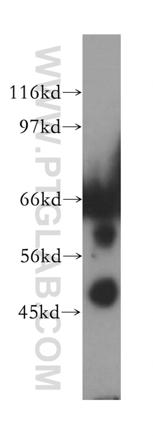 TULP2 Antibody in Western Blot (WB)