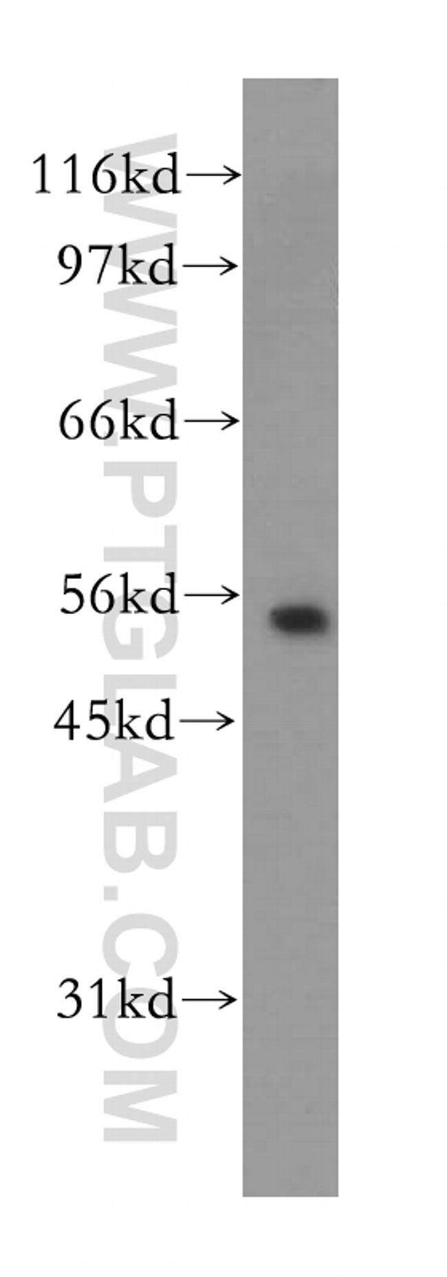 Kir5.1 Antibody in Western Blot (WB)
