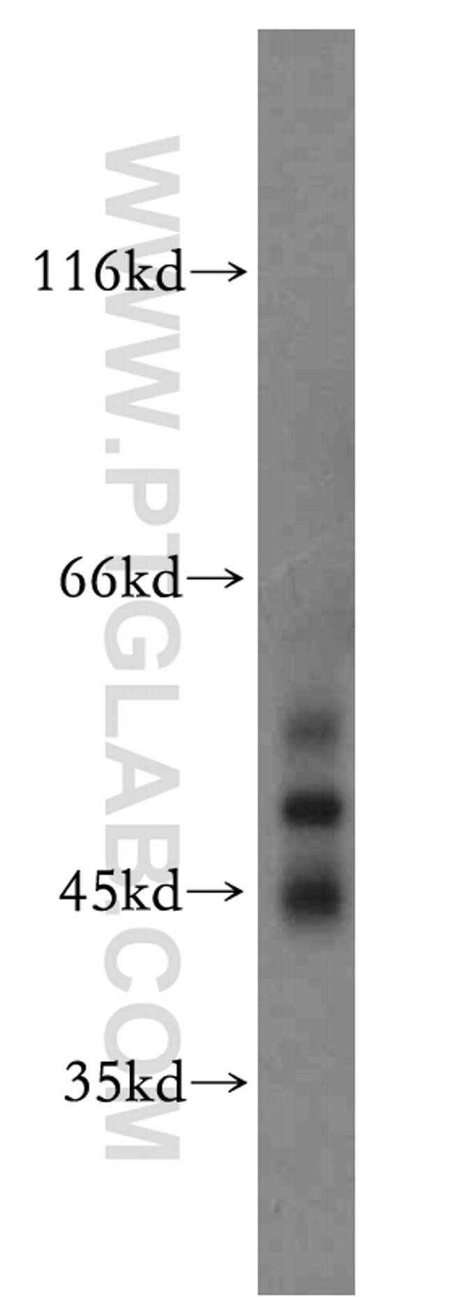 GABRA3 Antibody in Western Blot (WB)